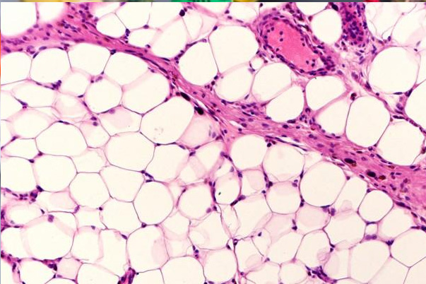 Can Weight Loss Drugs Affect Your Fertility? A Womans Guide